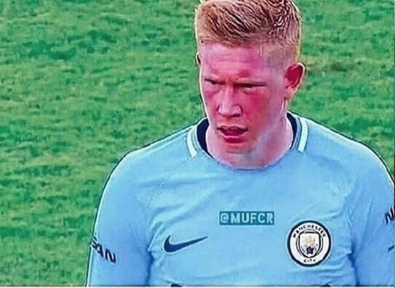 施洛特贝克：等到伤员都回归，我们可以击败任何球队